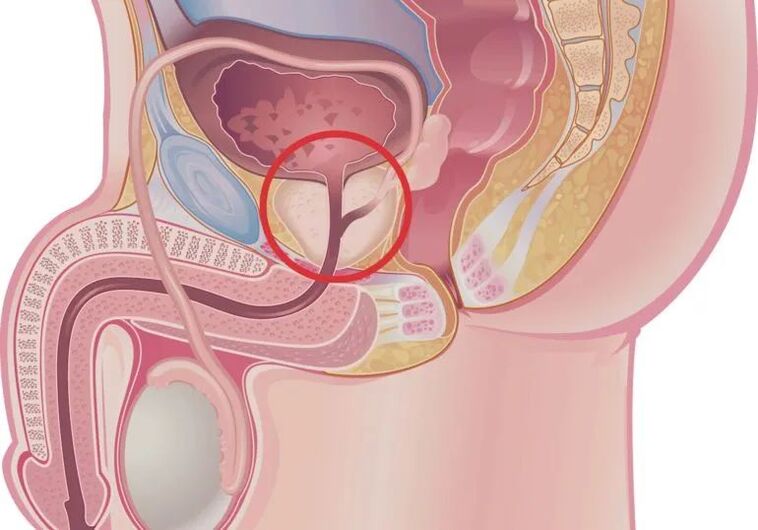 how does an erection happen